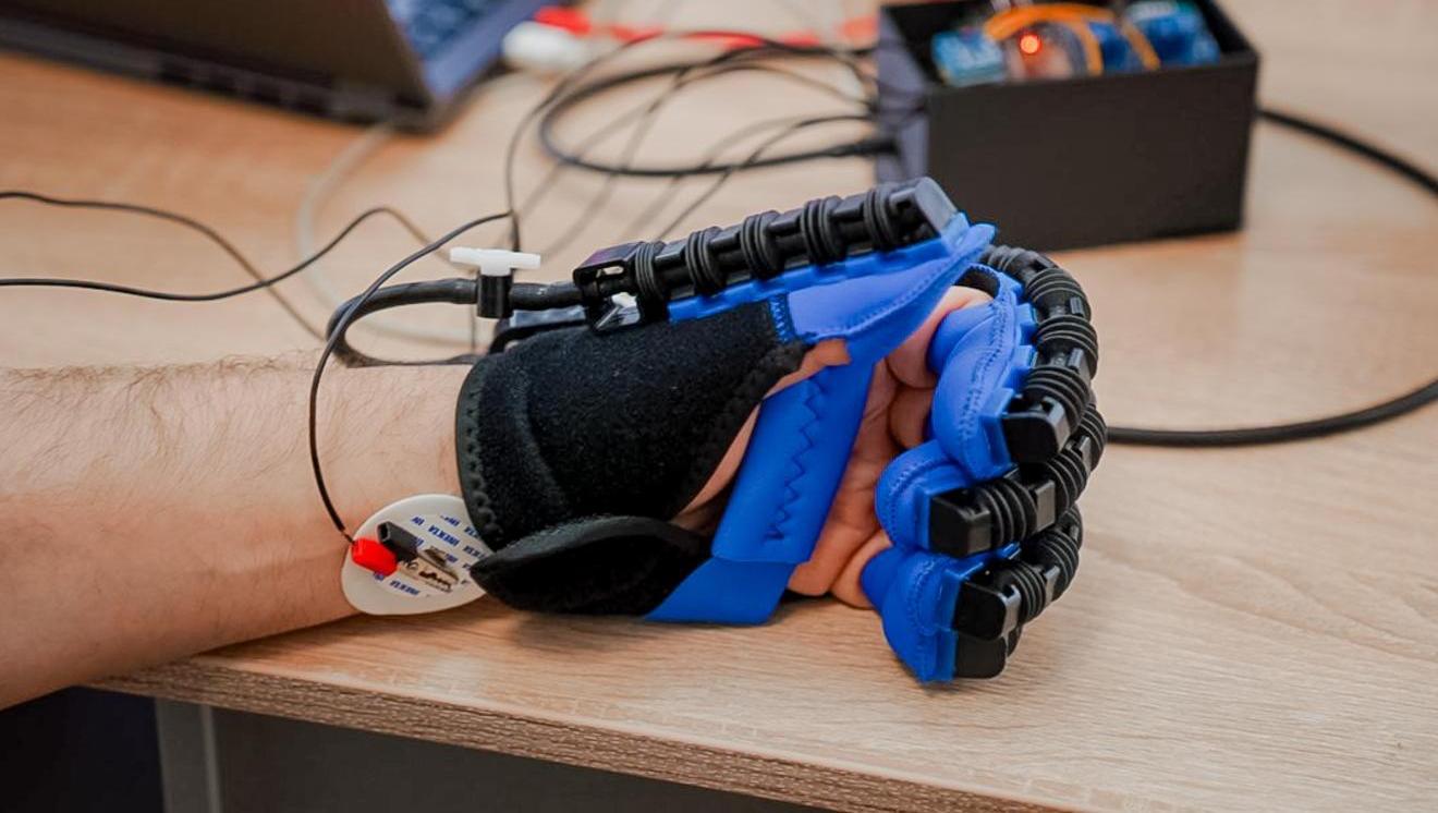 Бионическая перчатка с нейроинтерфейсом поможет в реабилитации пациентов